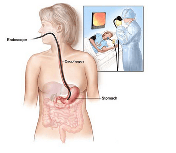 Nội soi dạ dày ở đâu tốt? Bệnh viện Thu Cúc