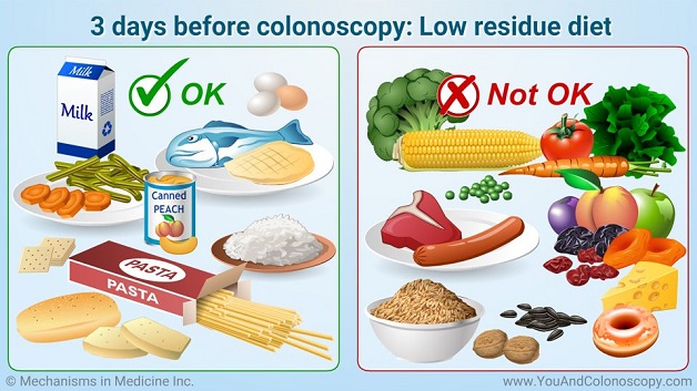 Nội soi đại tràng là gì? Bạn cần biết gì và cần chuẩn bị gì?