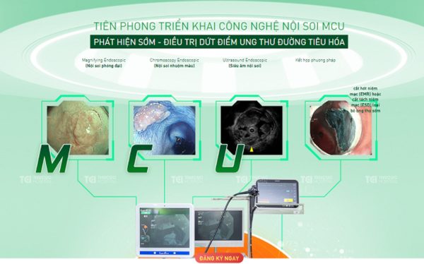 Nội soi MCU chẩn đoán ung thư đại tràng và điều trị dứt điểm ung thư sớm