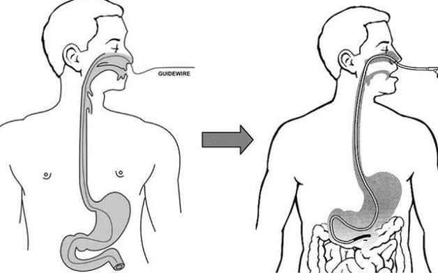 Nội soi qua đường mũi – Ưu điểm và những điều cần lưu ý