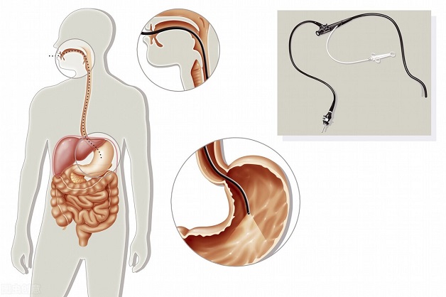 Nội soi thực quản dạ dày tá tràng được thực hiện khi nào?