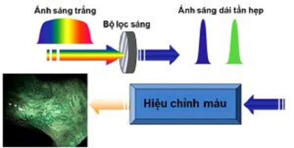 Nội soi tiêu hóa công nghệ NBI hiện đại hàng đầu hiện nay