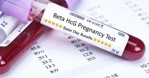 Nồng độ Beta hCG những điều bạn nữ cần biết