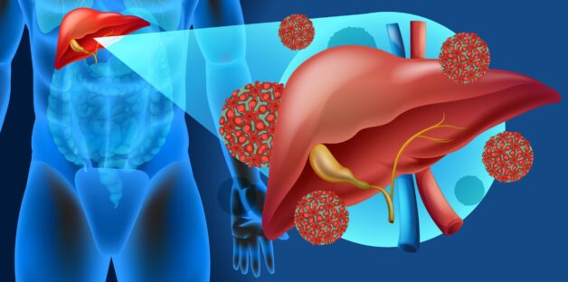 Nồng độ virus viêm gan B trong huyết tương