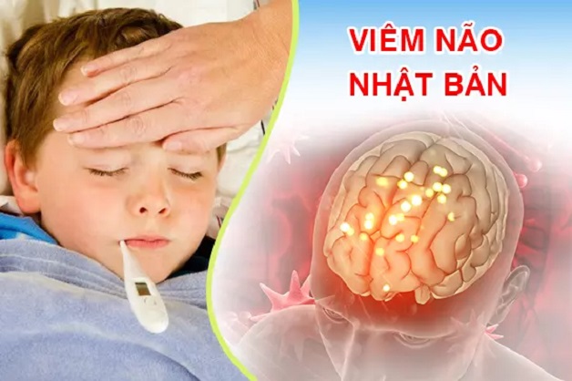 Phác đồ tiêm chủng viêm não Nhật Bản trẻ em