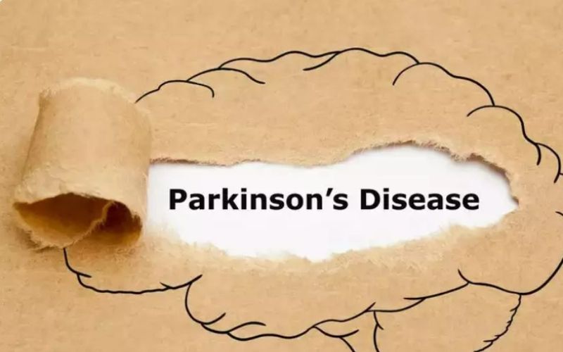 Phân biệt bệnh run vô căn và Parkinson – những điều cần biết