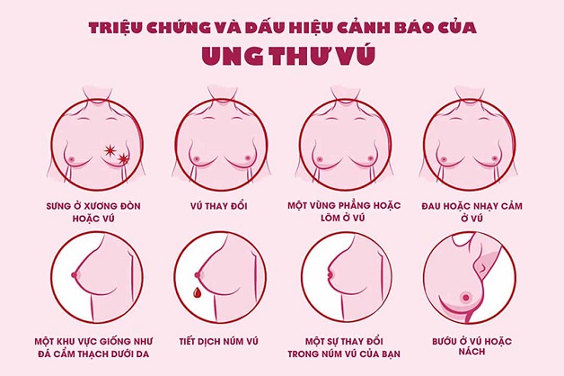 Phát hiện ung thư vú sớm bằng cách tầm soát định kỳ