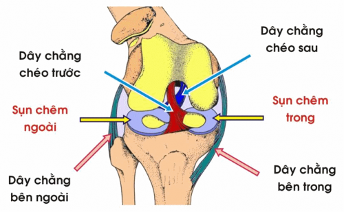 Phẫu thuật rách sụn chêm khi nào cần bắt buộc thực hiện?