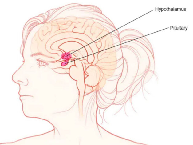 Phẫu thuật u tuyến yên: Mục tiêu, cách thực hiện