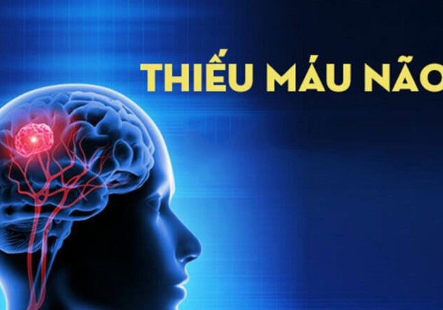 Phình đĩa đệm đốt sống cổ có nguy hiểm không?