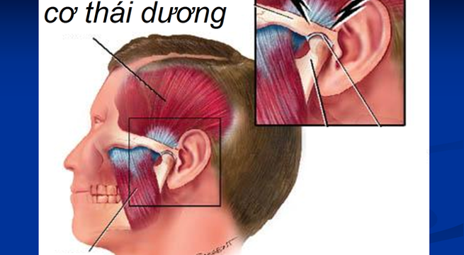 Phòng tránh rối loạn thái dương hàm