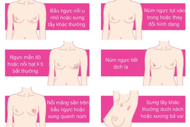 Phụ nữ 40 tuổi nên tầm soát ung thư vú ở bệnh viện nào?