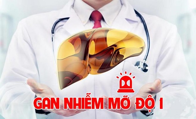 Phương pháp điều trị gan nhiễm mỡ độ 1 cực hiệu quả