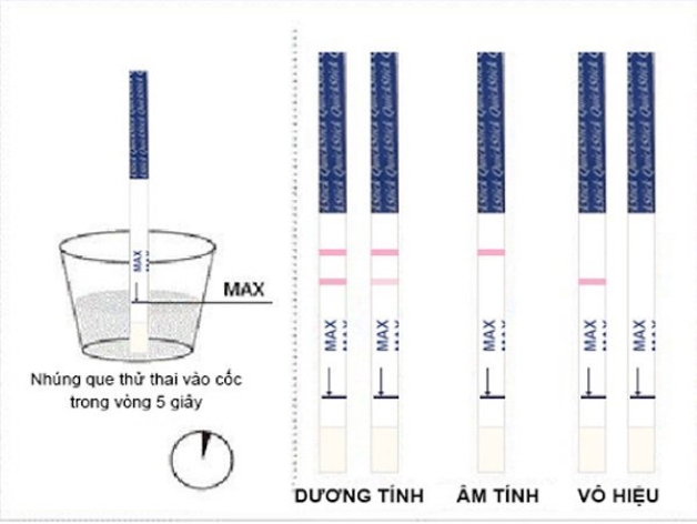 Phương pháp xét nghiệm có thai chính xác nhất hiện nay là gì?