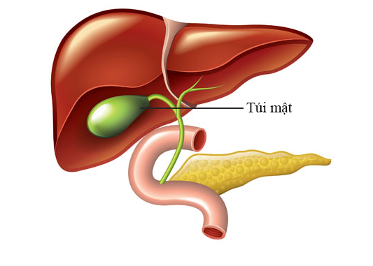 Polyp túi mật và nguy cơ ung thư hóa biểu mô túi mật