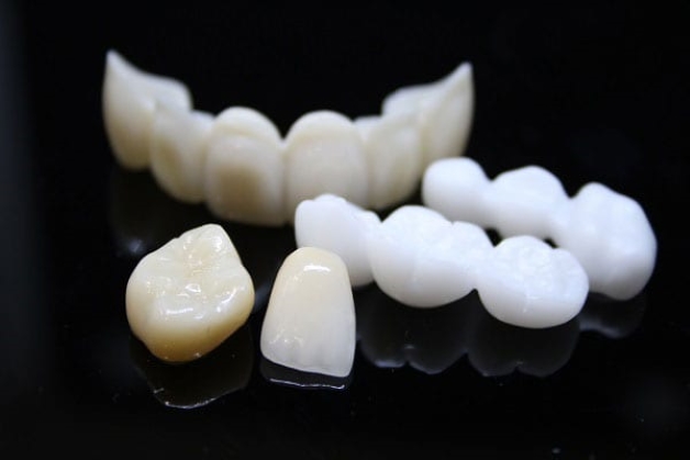 Răng sứ cao cấp Zirconia và những ưu điểm nổi bật