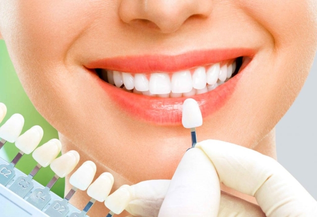 Răng sứ cao cấp Zirconia và những ưu điểm nổi bật