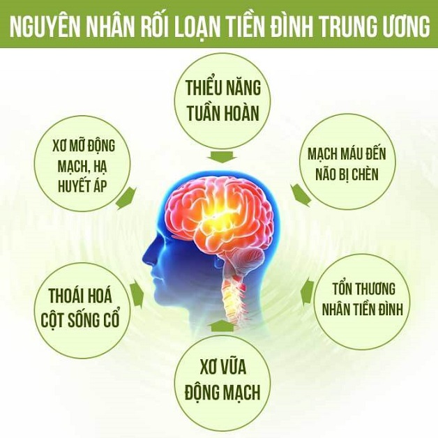 Rối loạn tiền đình trung ương nguy hiểm thế nào?