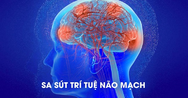 Sa sút trí tuệ “nỗi ám ảnh” của người già