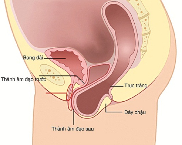 Sa trực tràng kiểu túi: nguyên nhân, triệu chứng và điều trị