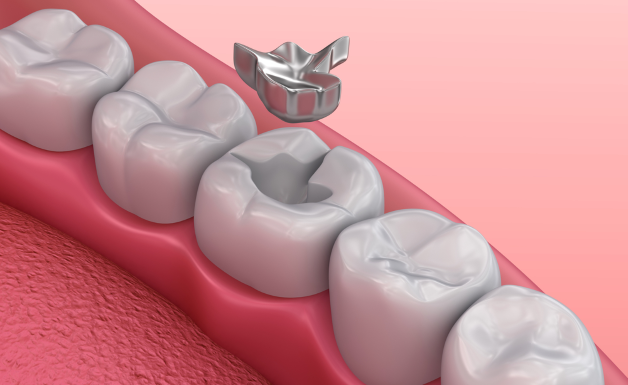 Sâu bên trong răng và cách để điều trị