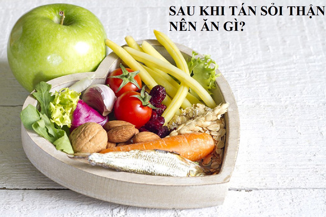 Sau khi tán sỏi thận nên ăn gì để nhanh hồi phục sức khỏe?