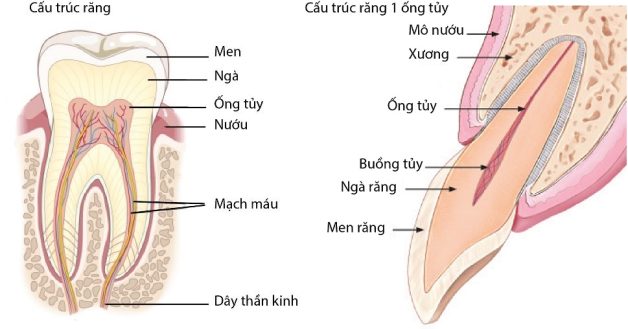 Sâu răng ăn vào tủy – Cẩn trọng tránh biến chứng nặng