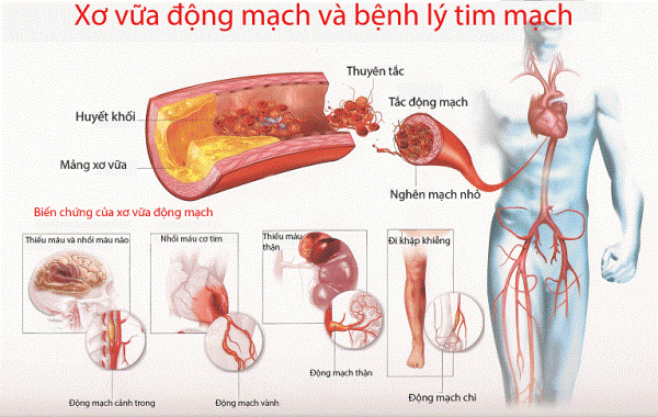 Siêu âm mạch máu ở đâu? vai trò siêu âm mạch