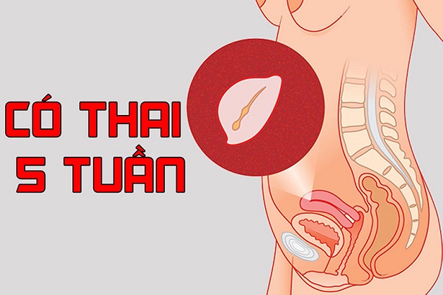 Siêu âm thai có yolksac là gì, nguy hiểm không?