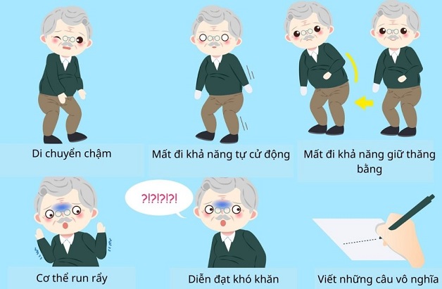 Sinh lý bệnh parkinson và nồng độ dopamin trong dịch não tủy