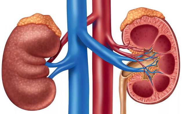 Sỏi thận xuống niệu quản – những nguy hiểm khó lường