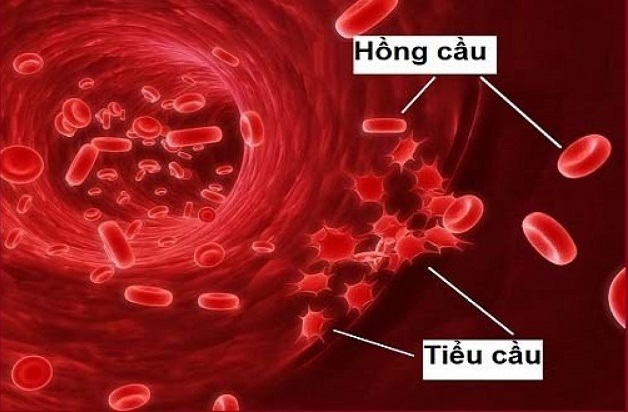 Sốt xuất huyết giảm tiểu cầu: Những điều cần biết