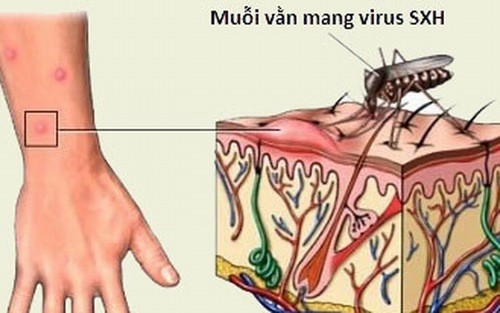 Sốt xuất huyết lây qua đường nào?