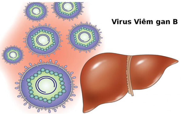 Sự cần thiết phải tiêm vắc xin viêm gan b cho trẻ sơ sinh