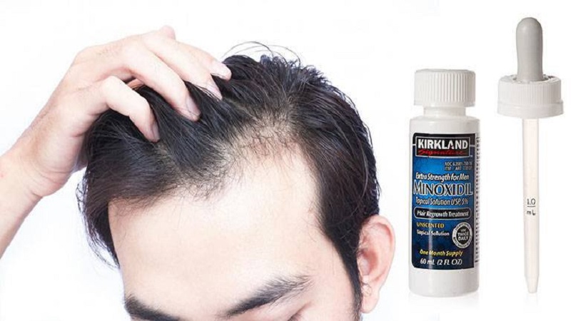 Sử dụng Minoxidil đúng cách để đạt hiệu quả tốt nhất