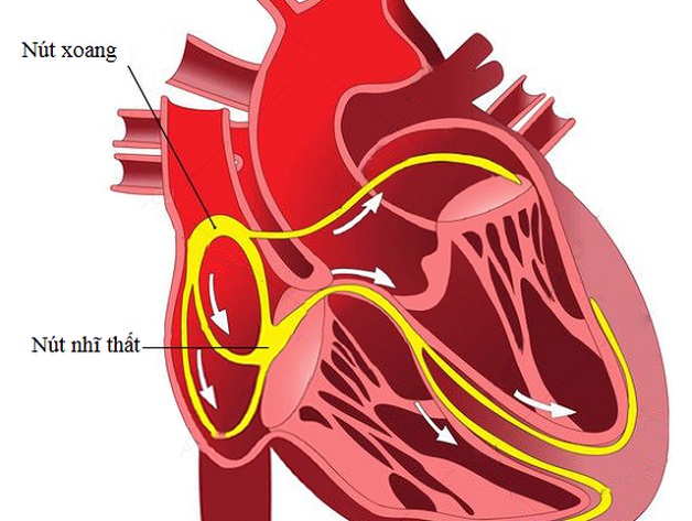 Suy nút xoang tim: Nguyên nhân, triệu chứng và điều trị