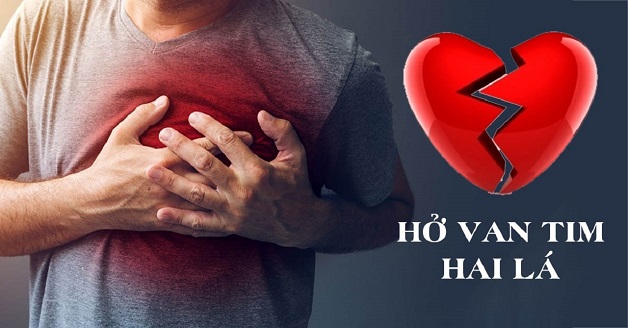 Suy tim có nguy hiểm không và cách phòng bệnh