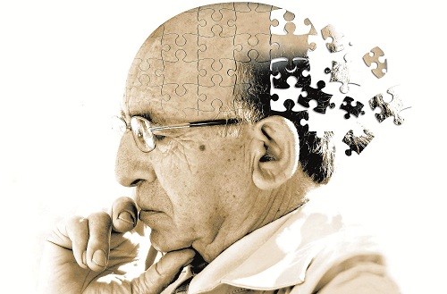 Tác động của bệnh Alzheimer bộ không hồi phục