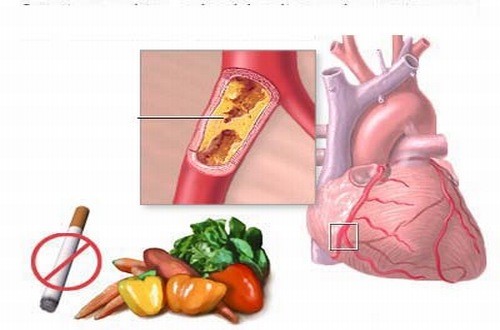 Tác động của thuốc lá với tim mạch có hại rất nhiều