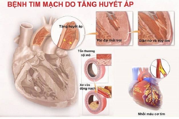 Tác hại do mất ngủ lâu ngày gây ra