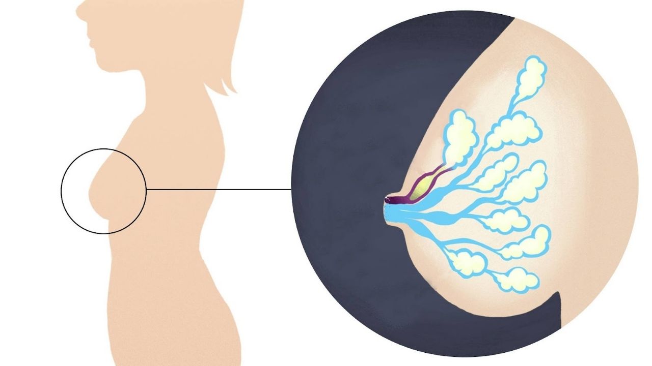 Tắc tia sữa sau khi cai sữa phải làm sao? Khi nào cần gặp bác sĩ?