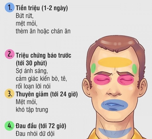 Tại sao đau nửa đầu lại tìm đến bạn? Cách phòng tránh