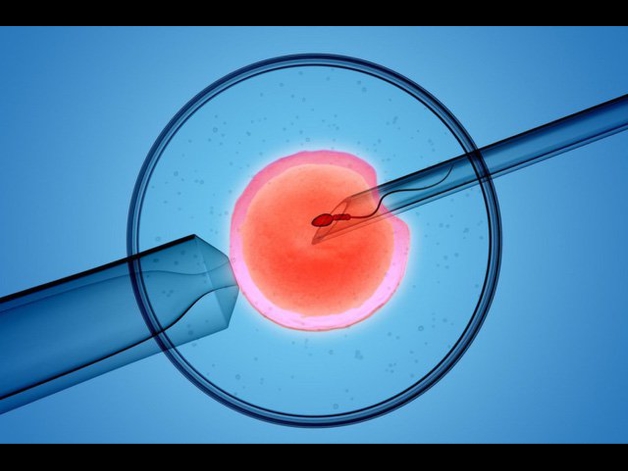 Tại sao phụ nữ lại bị rối loạn kinh nguyệt sau IVF?