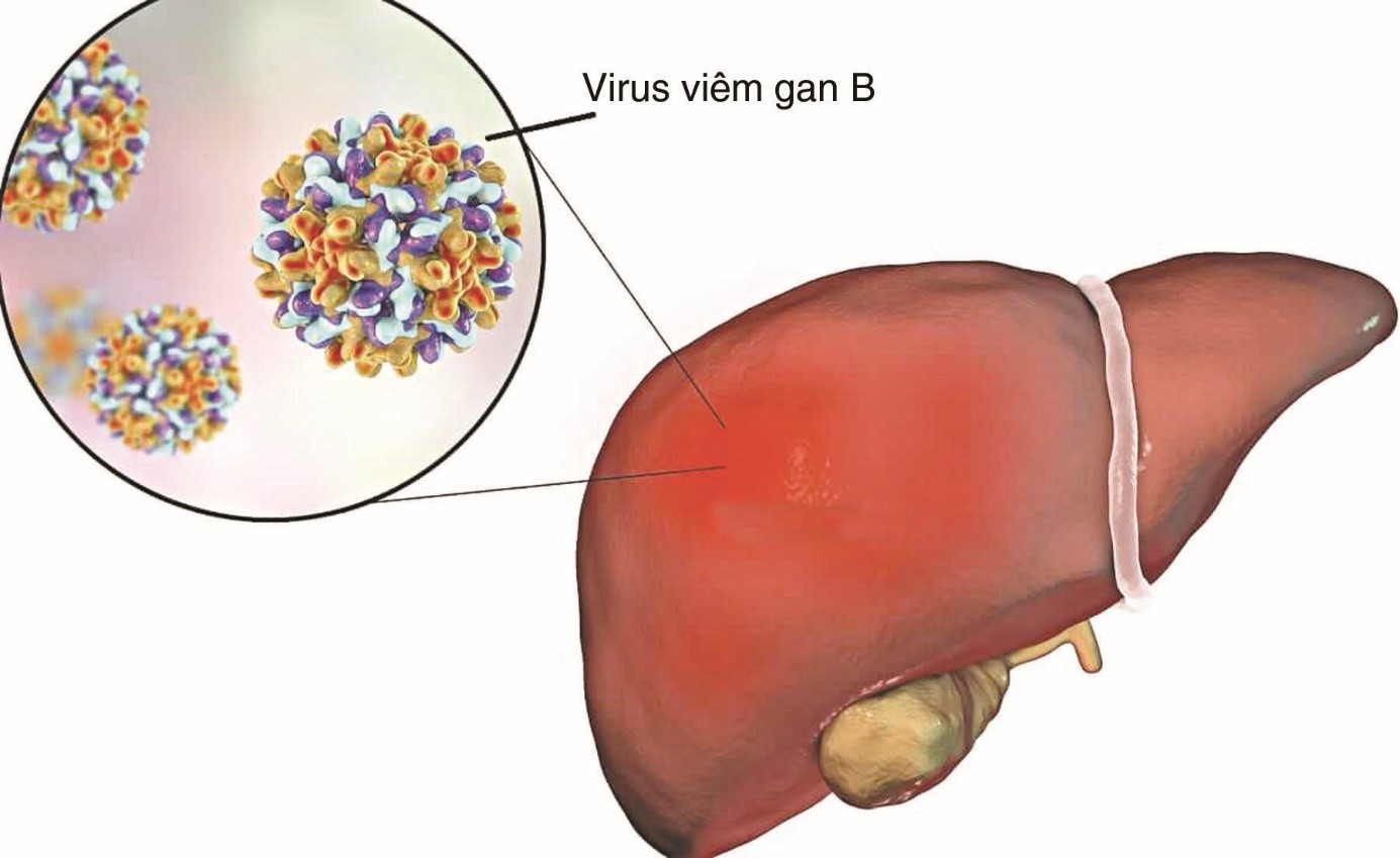 Tầm quan trọng của tiêm vắc xin viêm gan B cho người lớn