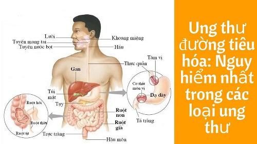 Tầm soát ung thư có cần nhịn ăn?