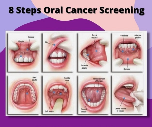 Tầm soát ung thư miệng: Làm thế nào để phát hiện?