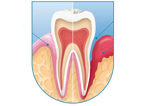 Tặng 50% liệu trình chăm sóc răng miệng tiêu chuẩn Nhật Bản