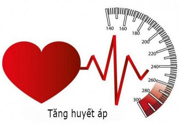 Tăng huyết áp nguyên phát: tìm hiểu về triệu chứng và cách phòng ngừa