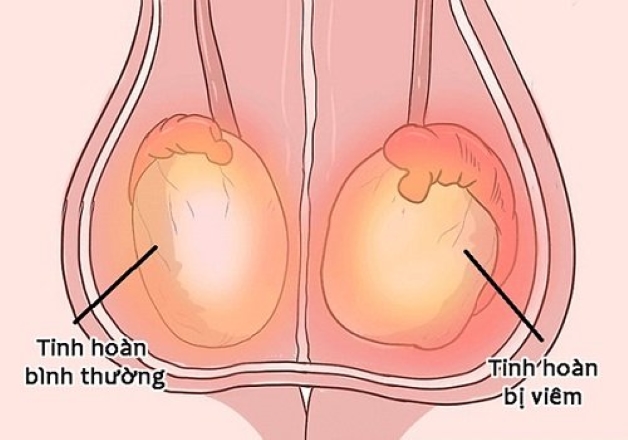 Thế nào là một phòng khám nam khoa đảm bảo chất lượng?