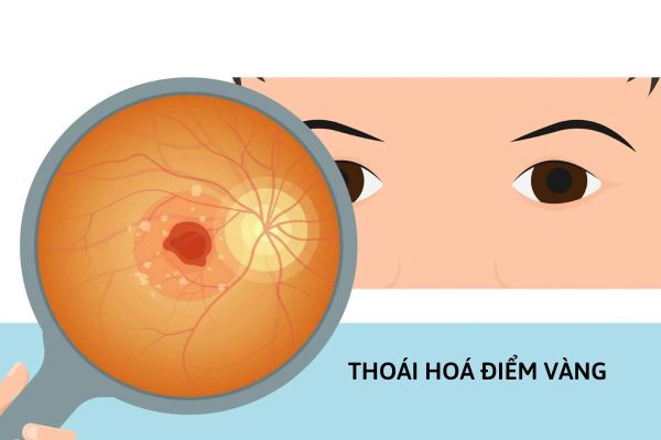 Thị lực kém do đâu và cách khắc phục như thế nào?